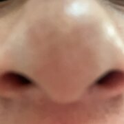 **113941003