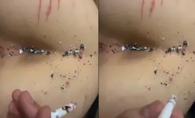 Một cô gái ở ký túc xá nữ bắt bạn cùng lớp cởi quần áo, dùng điện thoại di động quay phim âm hộ của cô ấy và ném tàn thuốc vào lỗ đít của cô ấy.